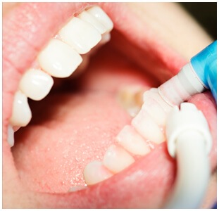 Periodontal (Gum) Care