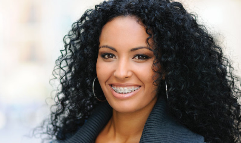 woman with dark curly hair and hoop earings smiles to show off her orthodontics