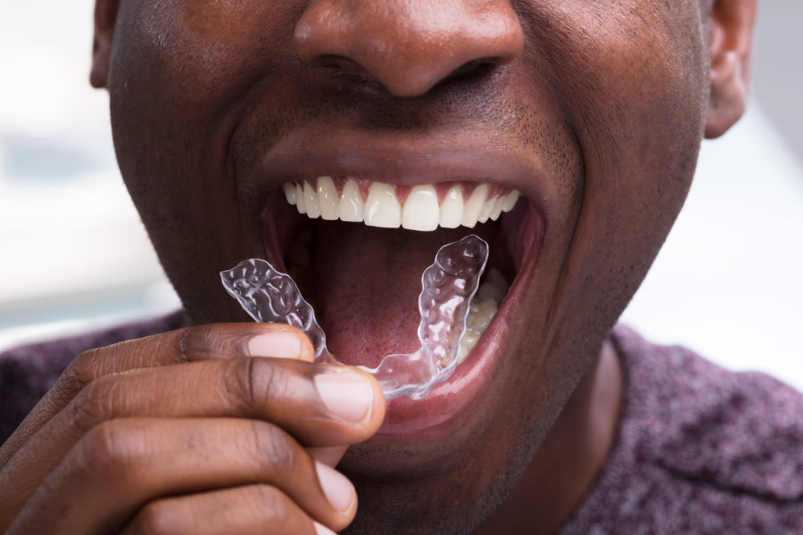 Black man removing an Invisalign aligner.